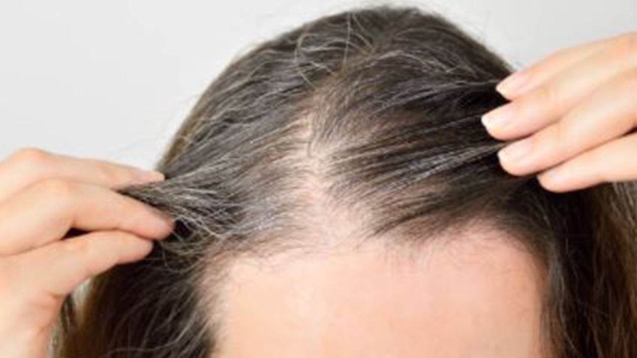 Onion juice for losing hair