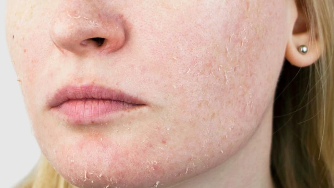 8 Best Vitamins And Supplements For Dry Skin