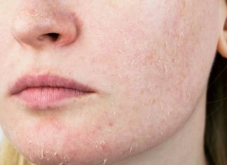 8 Best Vitamins And Supplements For Dry Skin