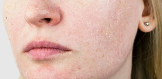 8 Best Vitamins And Supplements For Dry Skin
