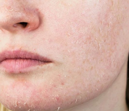 8 Best Vitamins And Supplements For Dry Skin