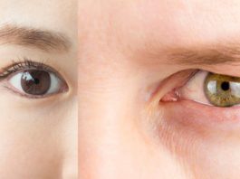 The Difference Between Monolid, Hooded Eyelids, and Double Eyelids