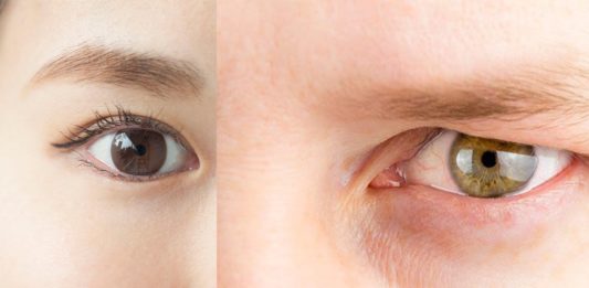 The Difference Between Monolid, Hooded Eyelids, and Double Eyelids The Difference Between Monolid, Hooded Eyelids, and Double Eyelids