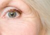 Common Age Related Eye Problems and Treatment Options Common Age Related Eye Problems and Treatment Options