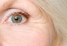 Common Age Related Eye Problems and Treatment Options