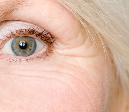 Common Age Related Eye Problems and Treatment Options