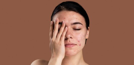 Most Common Skin Disorders: Symptoms, Causes, and Treatments Most Common Skin Disorders Symptoms, Causes, and Treatments