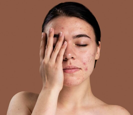 Most Common Skin Disorders Symptoms, Causes, and Treatments