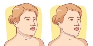 How To Get Rid of Double Chin? - 5 Neck Exercises